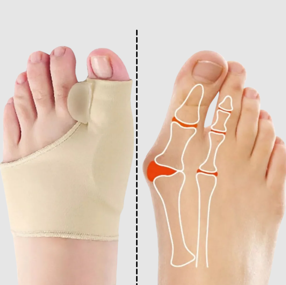 Gel bunion corrector - product detail 3