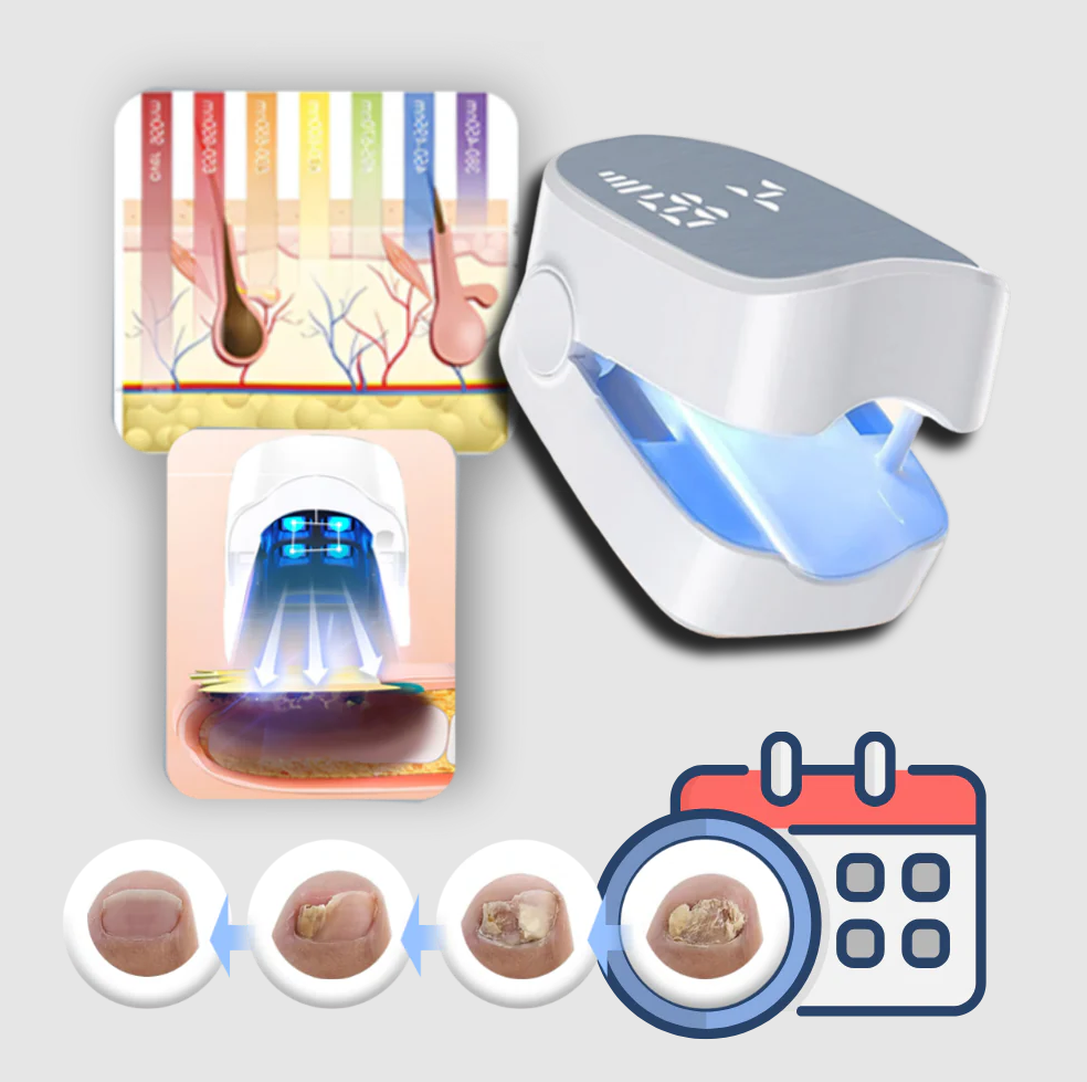 Painless Nail Fungus Laser - product detail 3