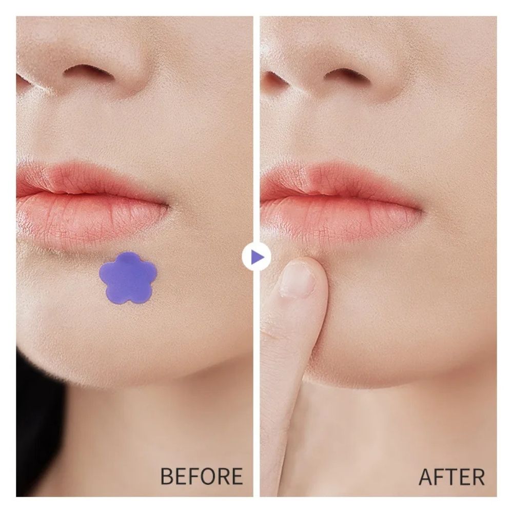 Hydrocolloid Pimple Acne Patch Sticker - product detail 6