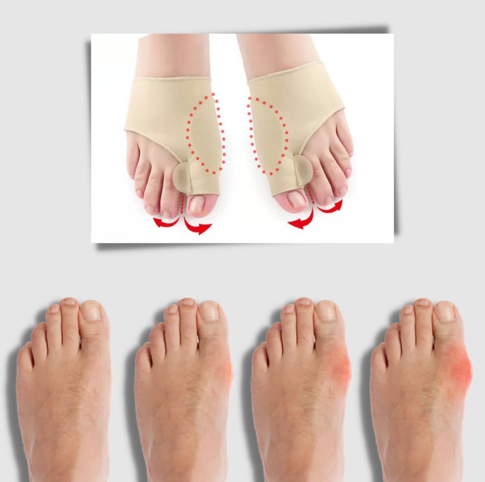 Gel bunion corrector - product detail 4