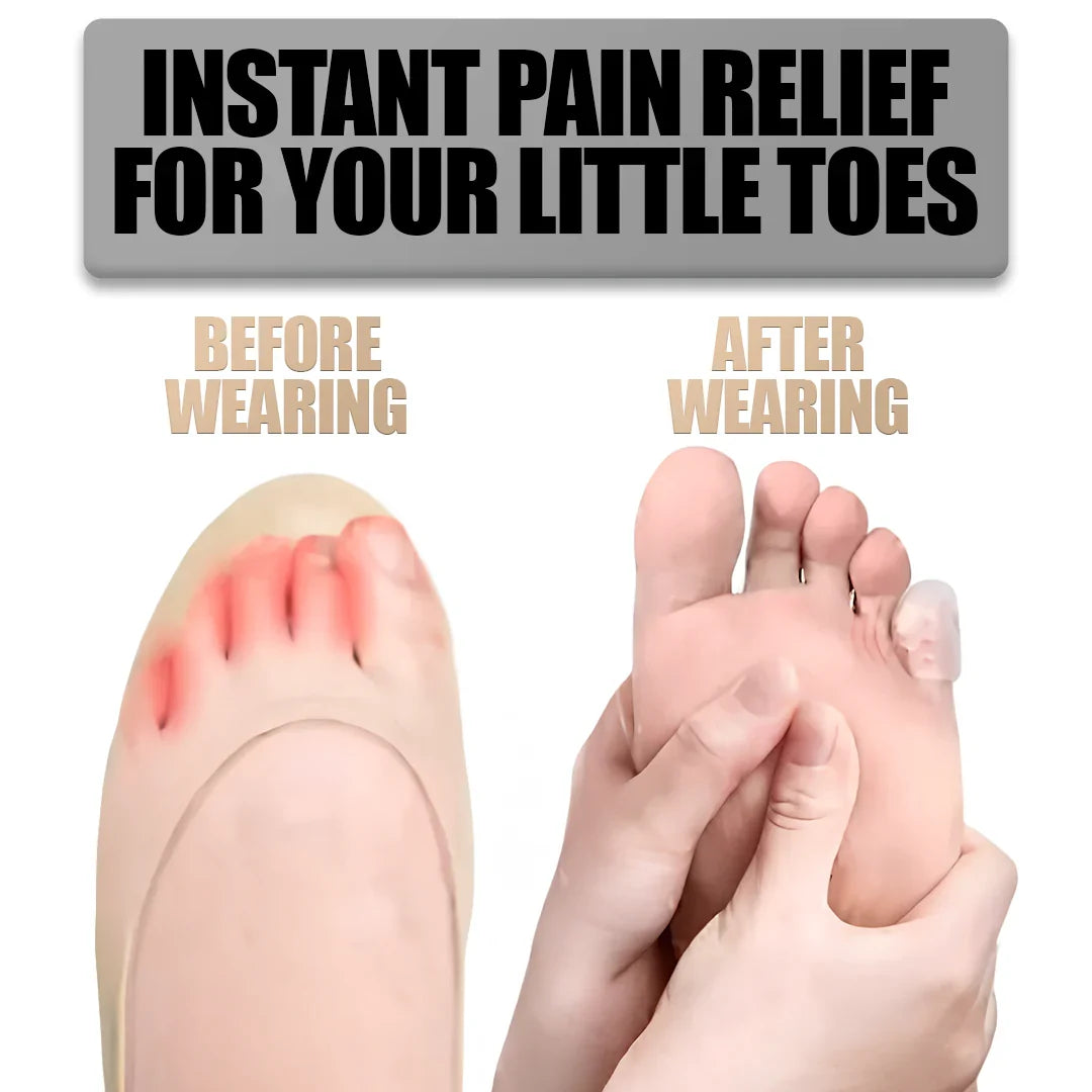 Silicone Anti-Friction Toe Protectors - product image 6