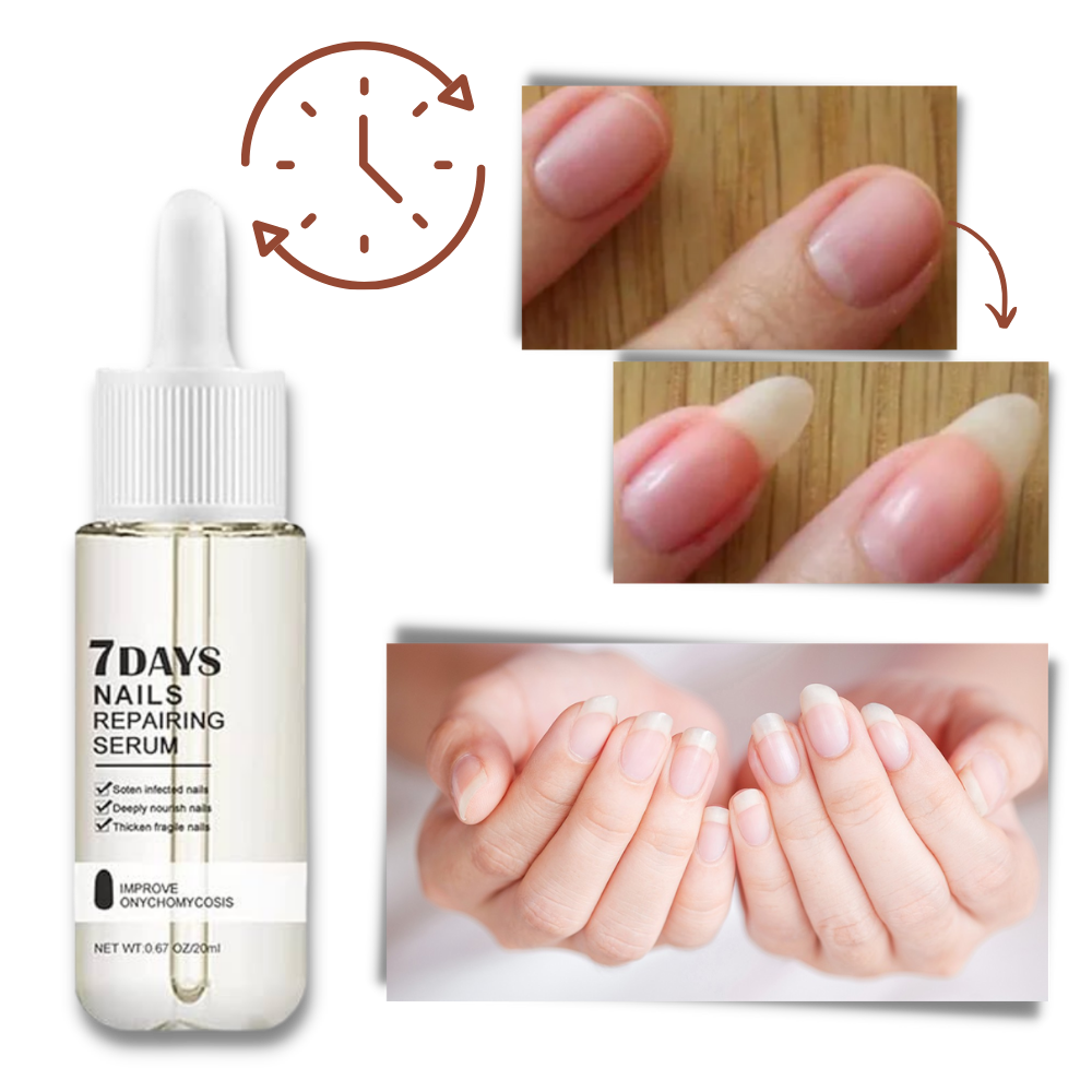 7 Days Nail Repair Essence - product detail 5