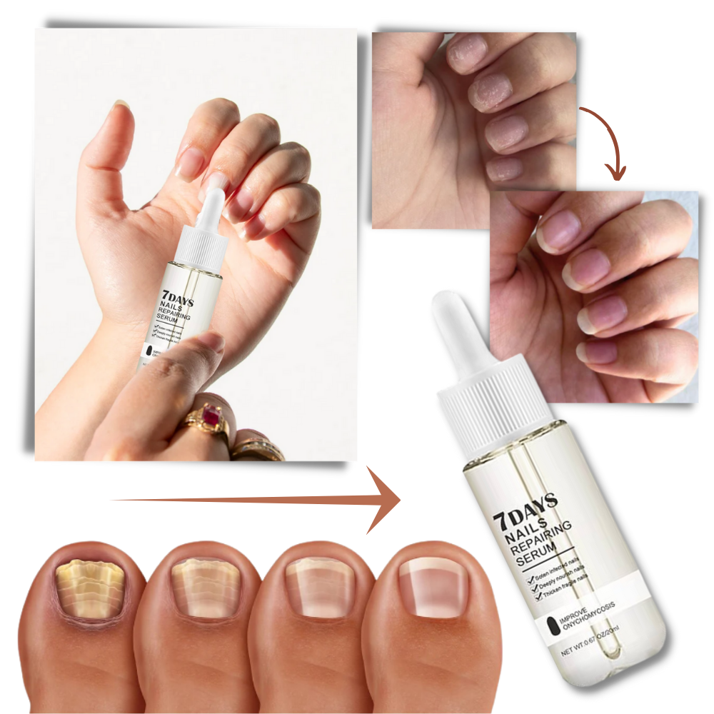 7 Days Nail Repair Essence - product detail 8
