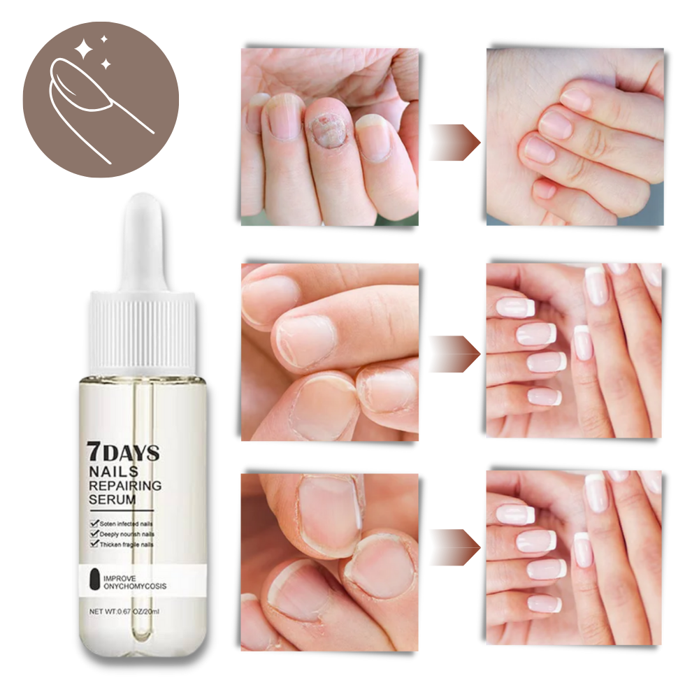7 Days Nail Repair Essence - product detail 7