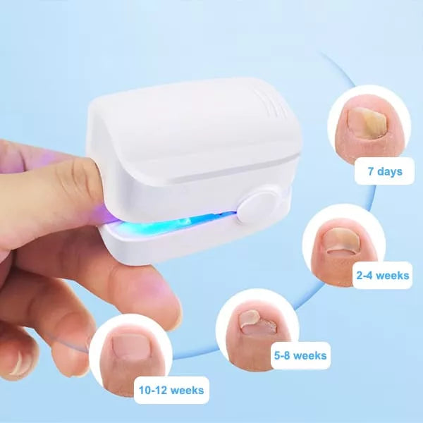 Nail Fungus Cleaning Laser Device - product image 3