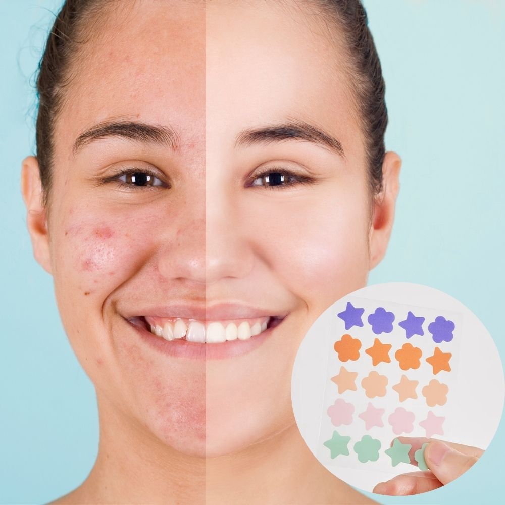 Hydrocolloid Pimple Acne Patch Sticker - product detail 2