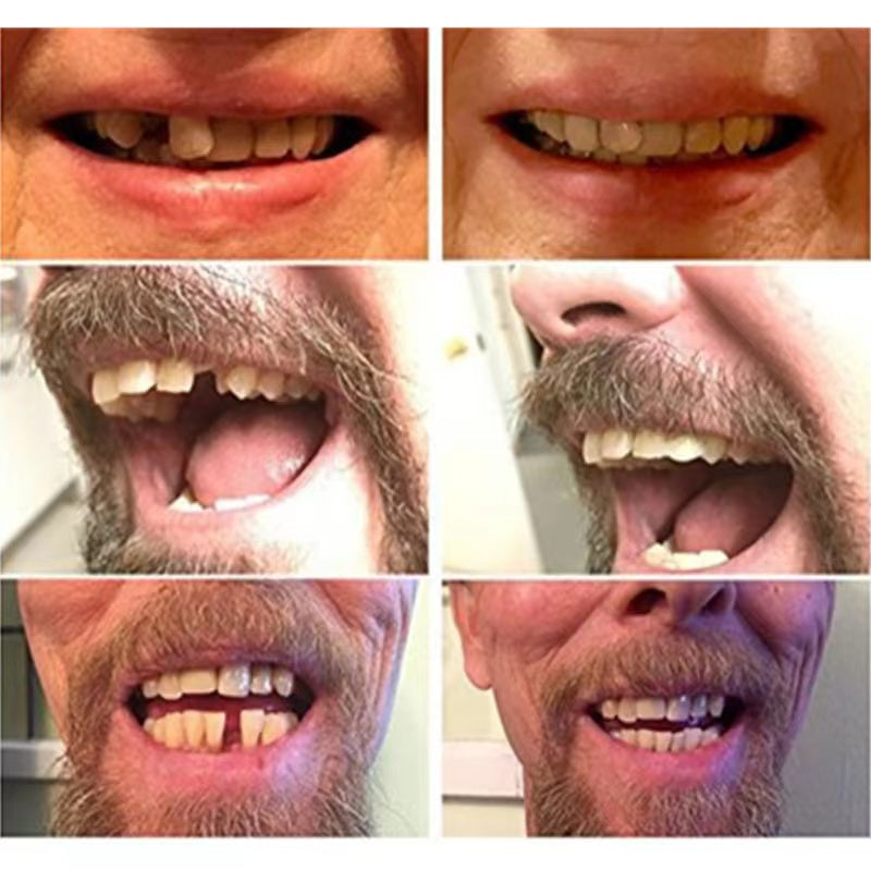 High-Quality False Teeth - product image 3