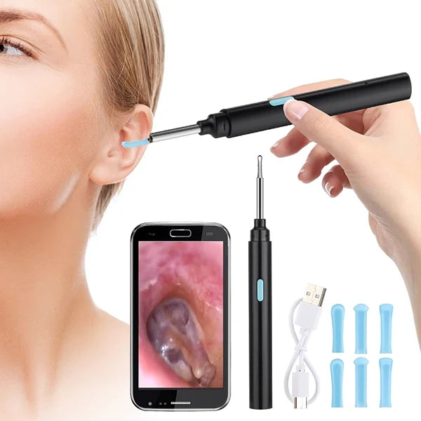 Intelligent Visual Device for Removing Earwax - product image 1