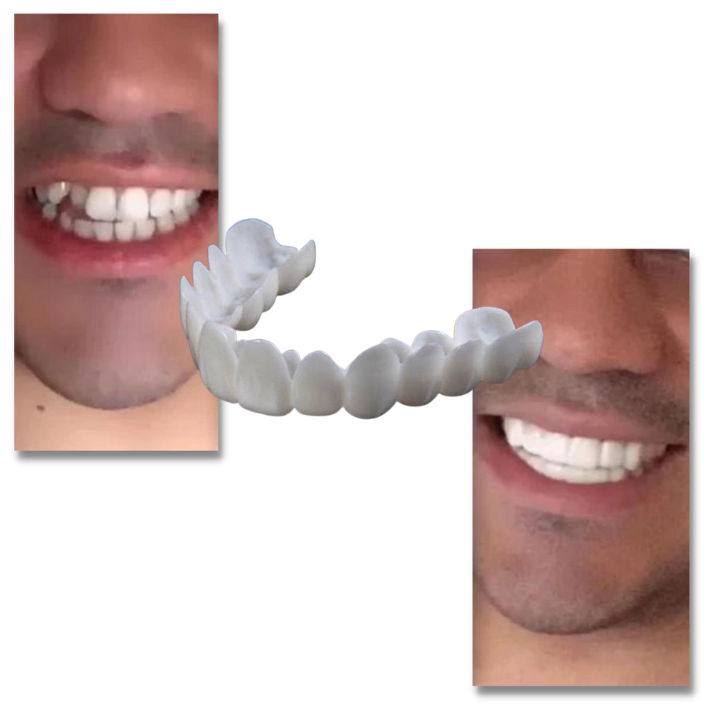 Dental coverage for a perfect smile - comfortable aligners - product detail 3