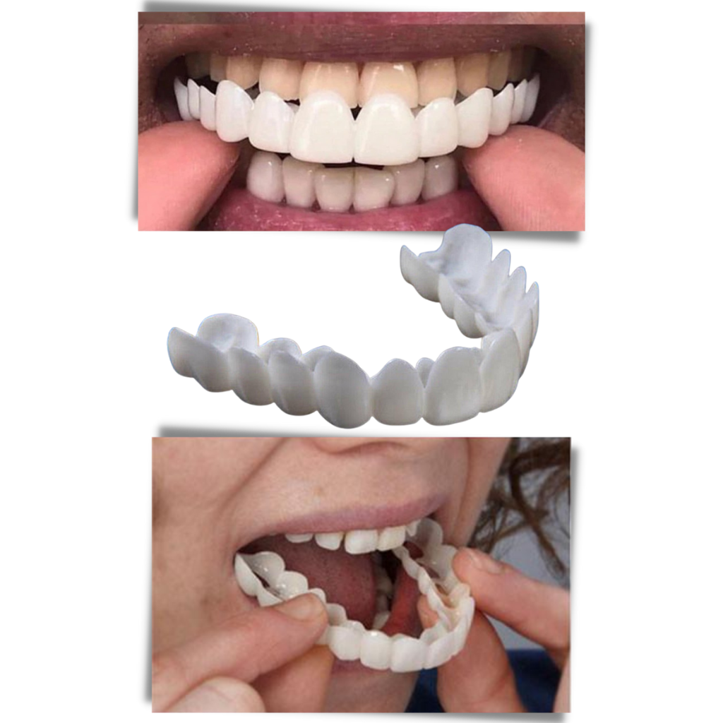 Dental coverage for a perfect smile - comfortable aligners - product detail 5