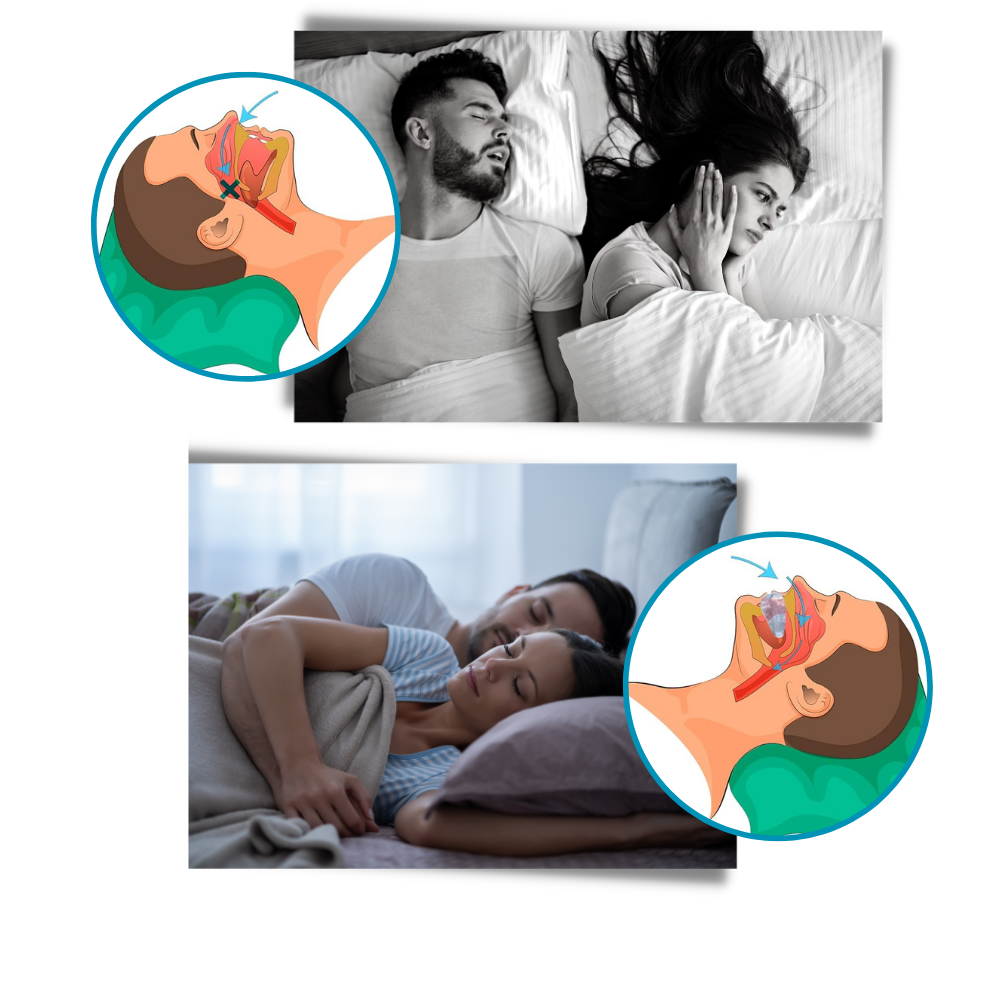 Advanced anti-snoring device - product detail 3