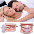NOMOVA Sleep Apnea Tongue Retainer, Non-Invasive Snoring Relief Aid
