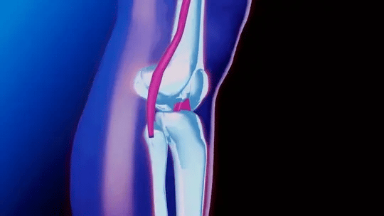 Knee Support with Adjustable Compression | - product detail 9