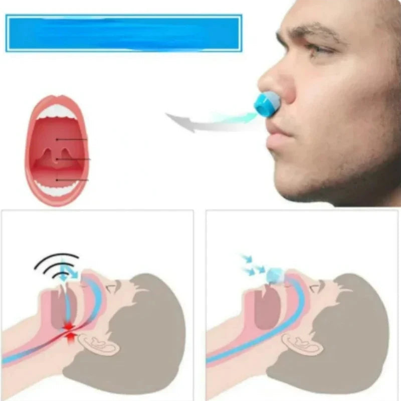 2-in-1 Anti Snore Device and Air Purifier Nose Clip - product detail 2