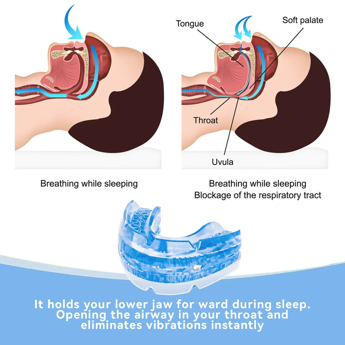 Adjustable Anti Snore Mouthpiece - product detail 3