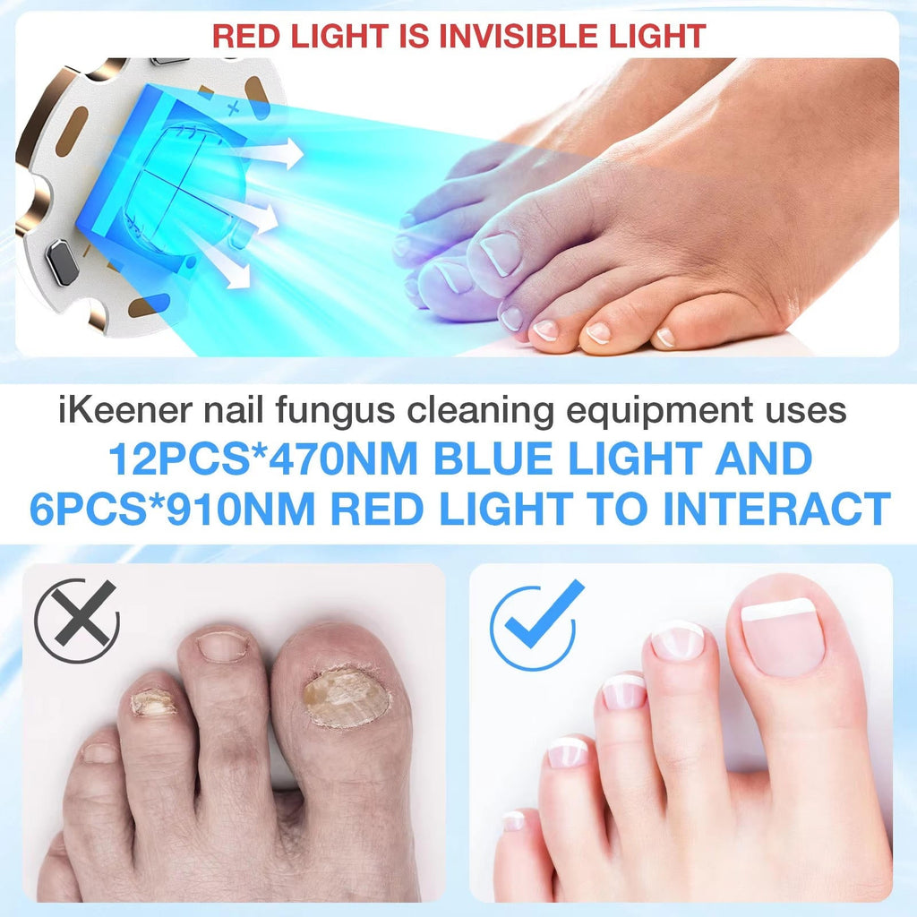 Nail Fungus Laser - product detail 4