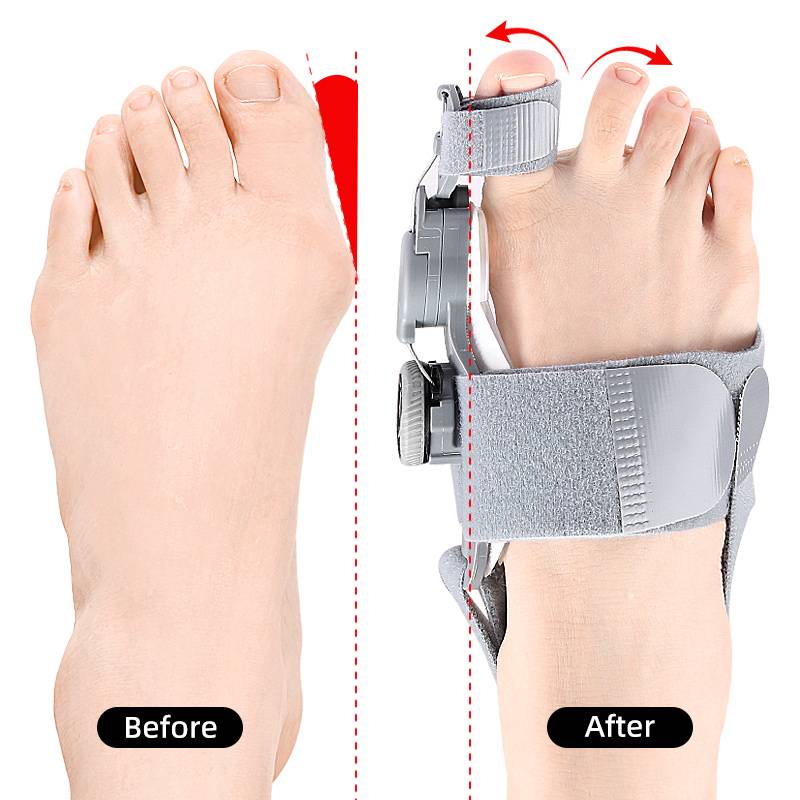 Natural Bunions Corrector Toe Spacer - product image 4