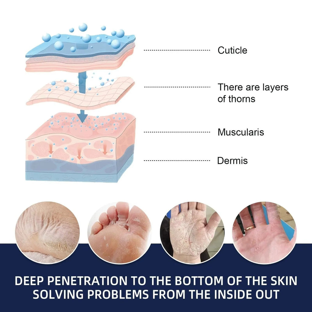 Cracked Foot Heel Treatment 3 Pack - product detail 8