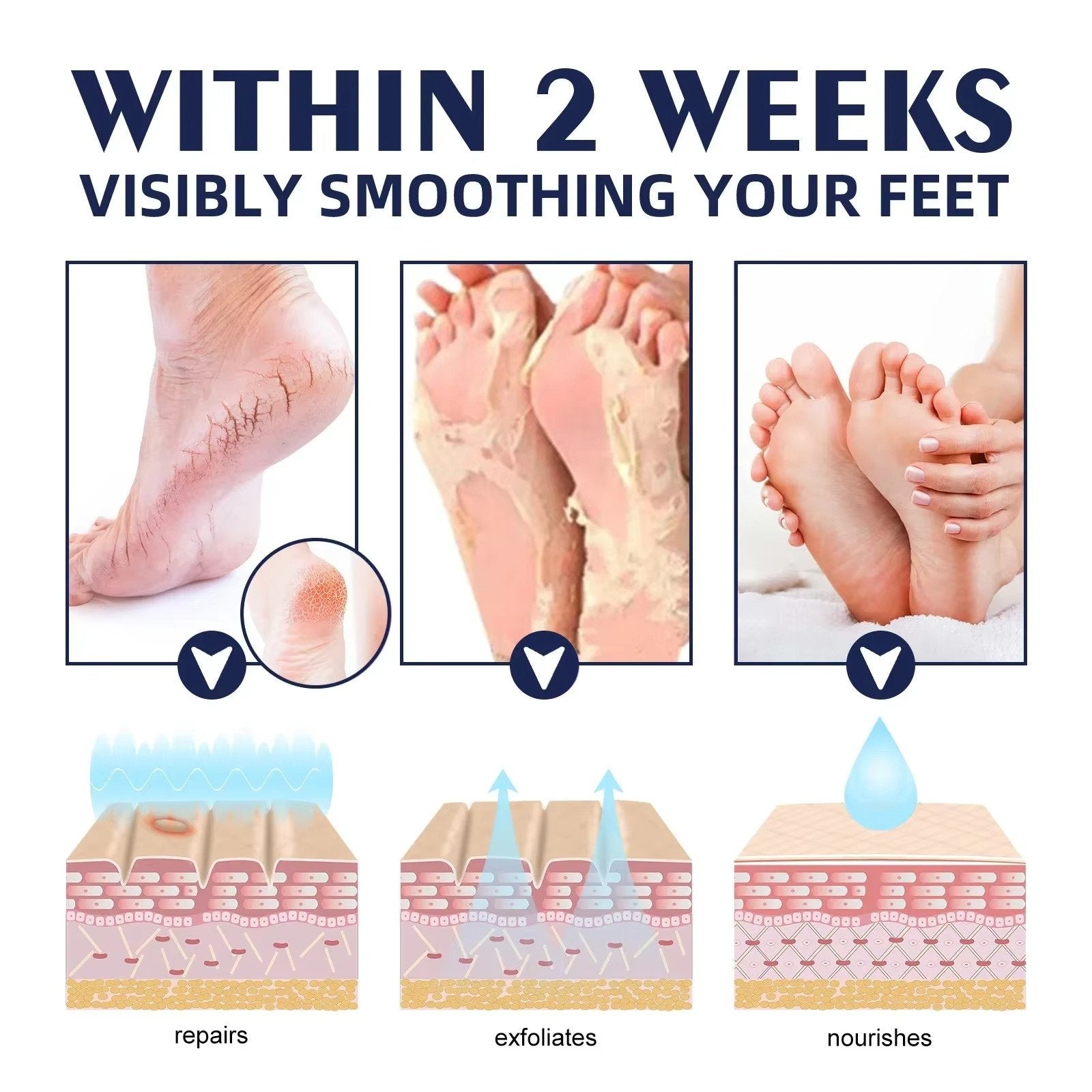 Cracked Foot Heel Treatment 3 Pack - product detail 6