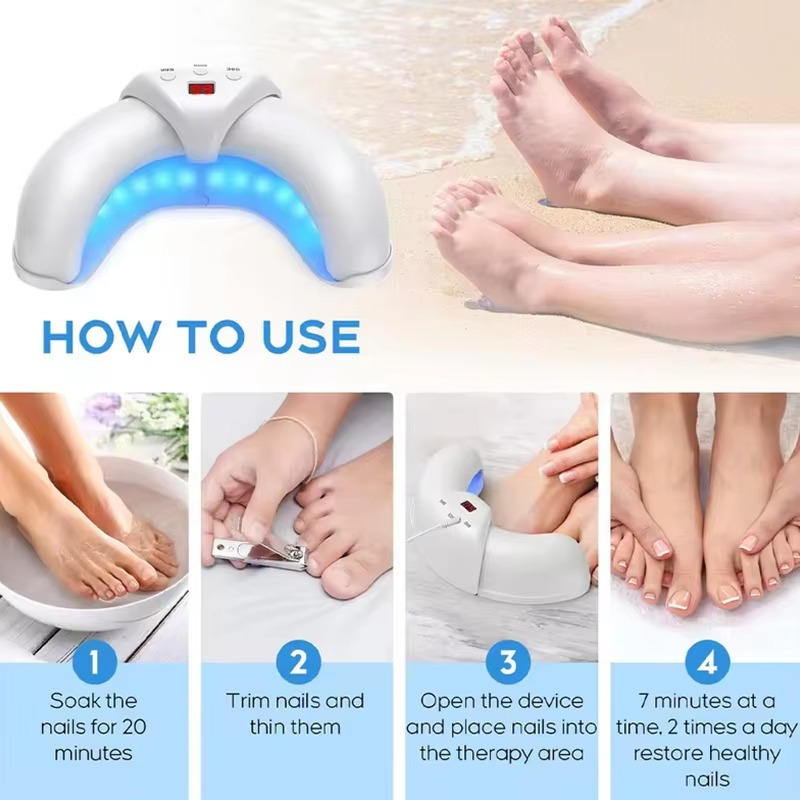 Nail Fungus Laser - product detail 7