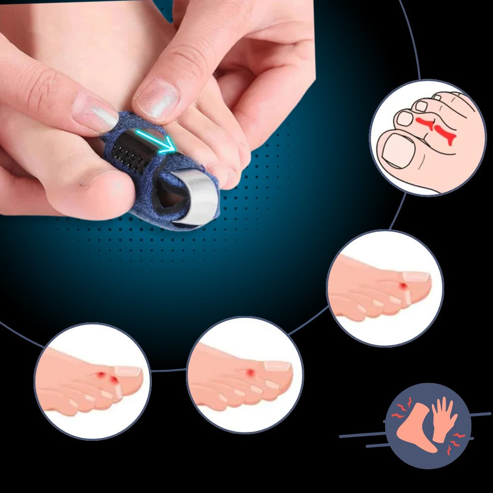 Toe Straightener with Adjustable Support - product detail 4