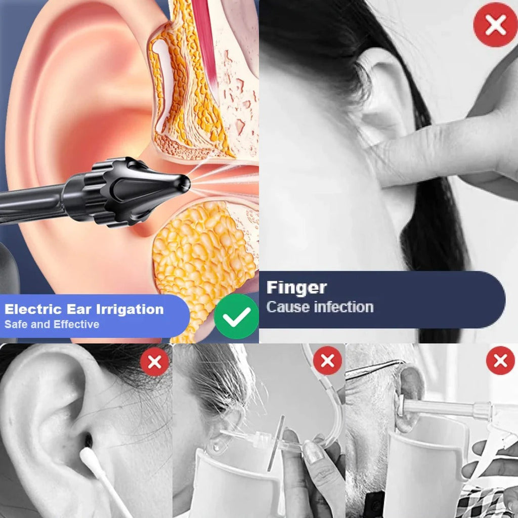 Ear Cleaning Irrigation Tool - product detail 2