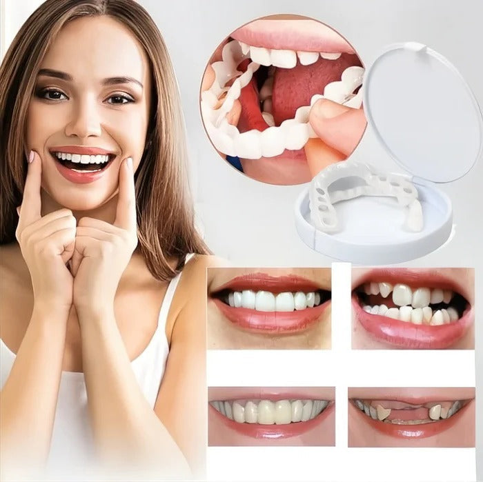 Veneers for Teeth with Natural White Finish - product detail 7