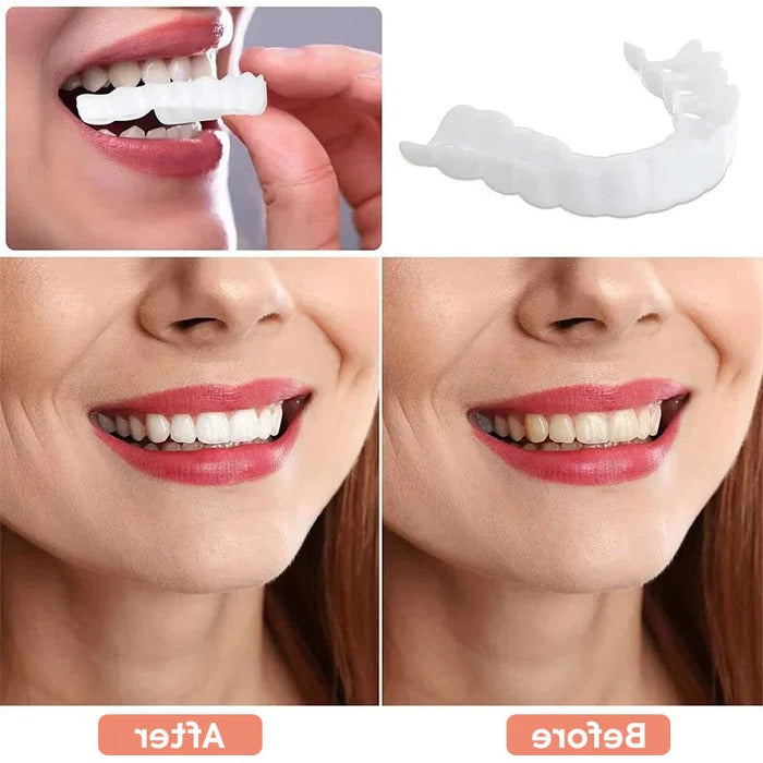 Veneers for Teeth with Natural White Finish - product detail 6