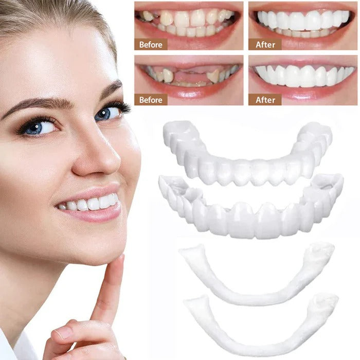 Veneers for Teeth with Natural White Finish - product detail 3