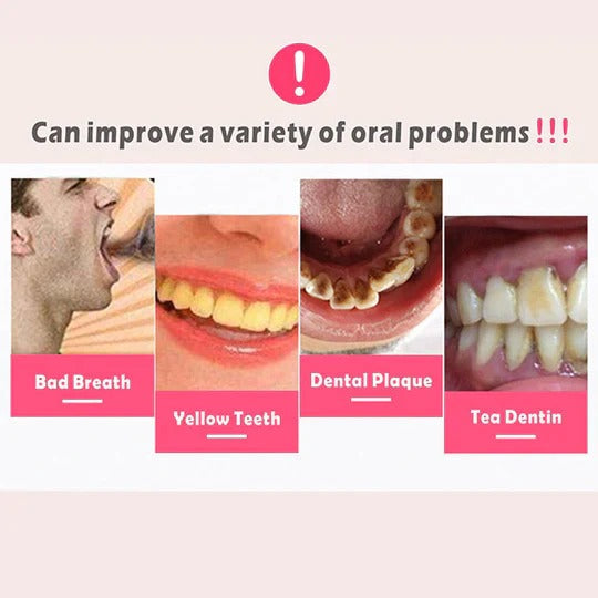 Plaque Remover for Teeth and Gums - product detail 3