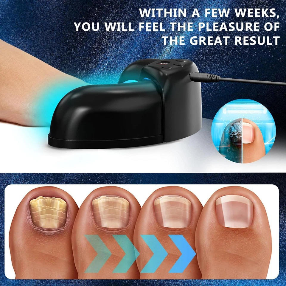 Nail Fungus Laser - product detail 14
