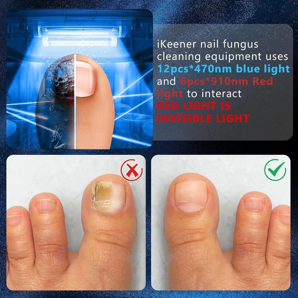 Nail Fungus Laser - product detail 13