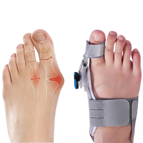 Natural Bunions Corrector Toe Spacer - product image 1