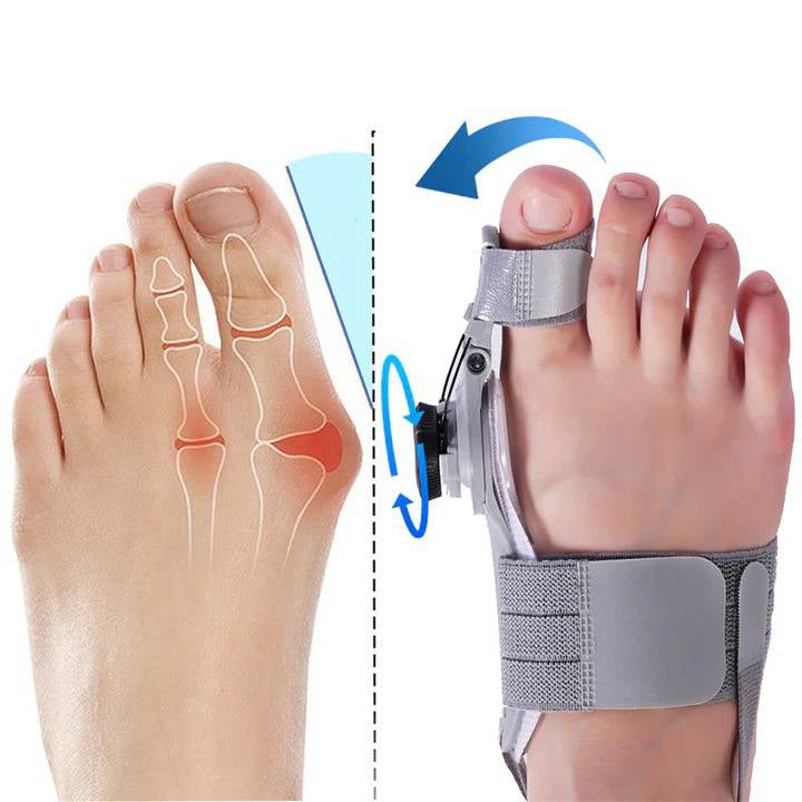Natural Bunions Corrector Toe Spacer - product image 2